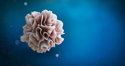 Які типи раку лікують вакцинами з дендритними клітинами