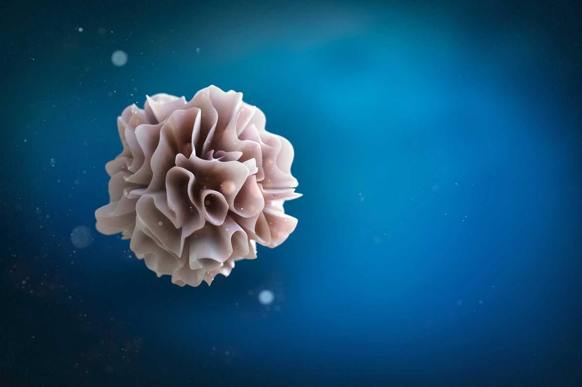 Какие типы рака лечат вакцинами с дендритными клетками